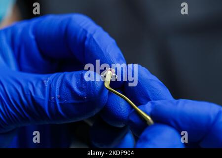 Metallspangen für die Montage der Struktur auf den Zähnen in den Händen eines Kieferorthopäden. Der Kieferorthopäde hält neue Zahnspangen in den Händen, bereitet sie vor Stockfoto