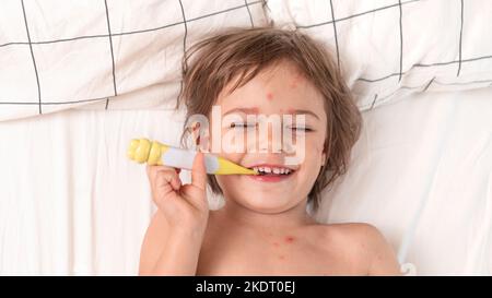 Kind mit Windpocken im Bett liegend mit Thermometer Stockfoto