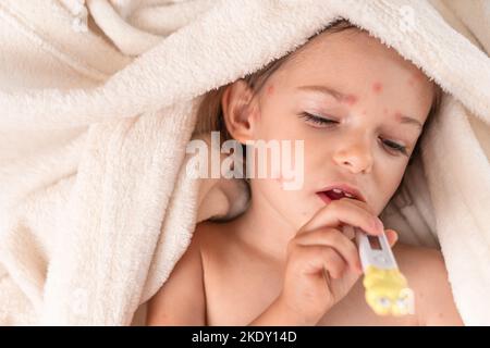 Kind mit Windpocken im Bett liegend mit Thermometer Stockfoto