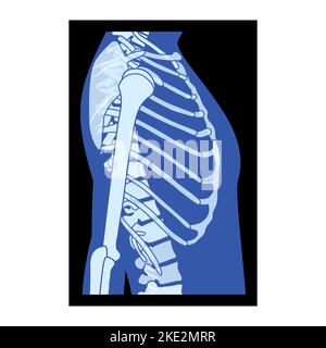 Röntgen-Rippenkäfig und Hände Skelett menschlicher Körper Knochen Erwachsene Menschen roentgen Seitenansicht. 3D realistisches flaches blaues Farbkonzept Vektordarstellung der medizinischen Anatomie auf schwarzem Hintergrund isoliert Stock Vektor