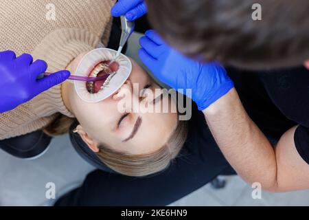 Die Zähne einer Frau mit Metallspangen werden in der Klinik behandelt. Ein Kieferorthopäde setzt Zahninstrumente ein, um Zahnspangen auf die Zähne eines Patienten zu legen. Auswahl Stockfoto