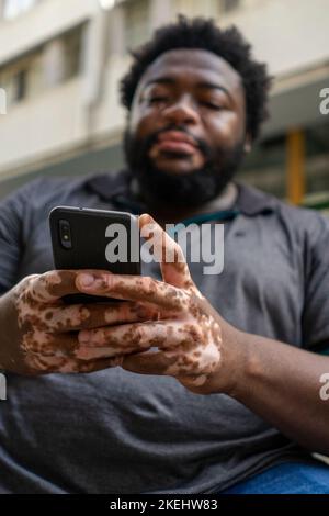 Ein Schwarzer mit Vitiligo benutzt ein Smartphone Stockfoto