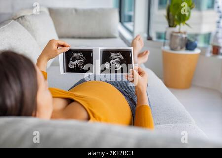 Ultraschall, der den Schwangerschaftskonzept mit einer Schwangeren, die auf das erste Foto ihres Babys schaut und freudig die Geburt ihres 1.-jährigen Kindes erwartet Stockfoto
