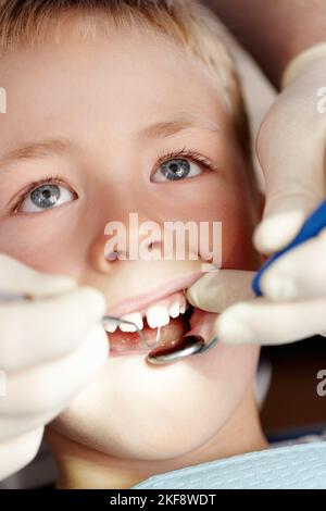 Kleiner Junge bekommt seine Zahnbehandlung. Nahaufnahme des entzückenden kleinen Jungen, der seine zahnärztliche Behandlung in der Klinik gemacht hat. Stockfoto