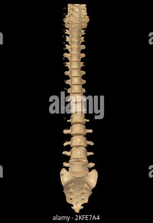 CT-Scan der gesamten Wirbelsäule 3D mit Darstellung der Profilwirbelsäule. Muskel-Skelett-System Menschlicher Körper. Struktur Der Wirbelsäule. Untersuchung von Problemerkrankungen und Trea Stockfoto