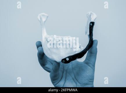 Person hält in der Hand 3D bedruckter Kunststoff-Prototyp menschlicher Unterkiefer und medizinisches Titan-Implantat Nahaufnahme. Prothese anatomischer Knochen 3D aus Metallpulver gedruckt. Orthopädische Kiefer-Gesichts-Prothese Stockfoto