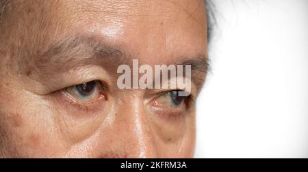 Hautfalten um das Auge des älteren asiatischen Mannes, der altert. Stockfoto