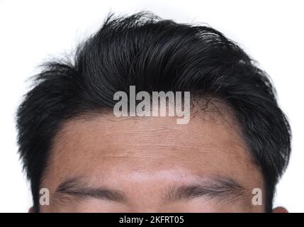 Dünner werdendes oder spärliches Haar, Haarausfall nach männlichem Muster. Falten oder Falten in der Stirn des südostasiatischen, chinesischen Mannes. Stockfoto