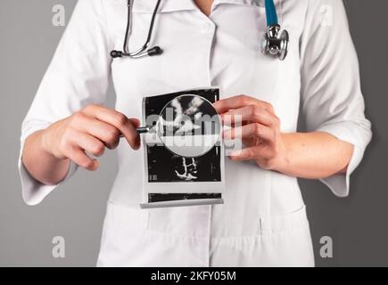 Ultraschalluntersuchung des Herzens, Papierdokument in der Hand des Arztes. Kardiologie, Gesundheitskonzept. Hochwertige Fotos Stockfoto