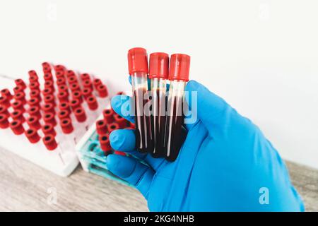 Ein Bluttest Probenröhrchen mit rotem Verschluss befindet sich in der Hand eines blau behandelten Arztes, Hämatologie-Labor-Konzept Stockfoto