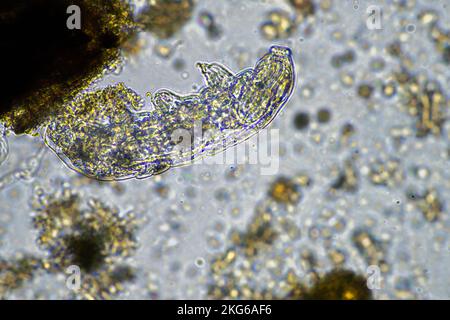 Menschlicher Parasit. Intestinale Infektionskrankheit. Mikroorganismus-Infektion im Krankenhaus beim Menschen Stockfoto
