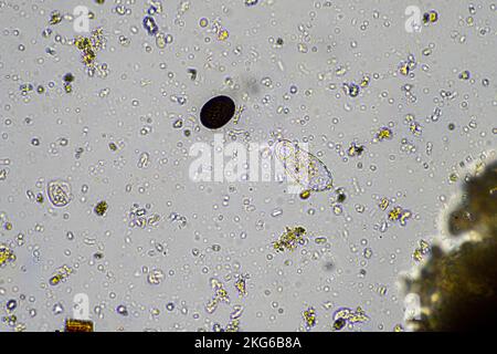 Menschlicher Parasit. Intestinale Infektionskrankheit. Mikroorganismus-Infektion im Krankenhaus beim Menschen Stockfoto