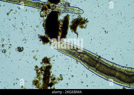 Menschlicher Parasit. Intestinale Infektionskrankheit. Mikroorganismus-Infektion im Krankenhaus beim Menschen Stockfoto