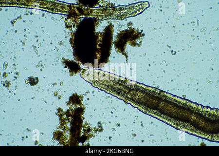 Menschlicher Parasit. Intestinale Infektionskrankheit. Mikroorganismus-Infektion im Krankenhaus beim Menschen Stockfoto