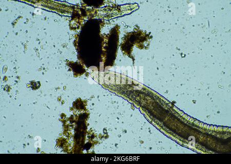 Menschlicher Parasit. Intestinale Infektionskrankheit. Mikroorganismus-Infektion im Krankenhaus beim Menschen Stockfoto