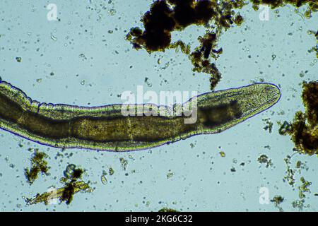 Menschlicher Parasit. Intestinale Infektionskrankheit. Mikroorganismus-Infektion im Krankenhaus beim Menschen Stockfoto