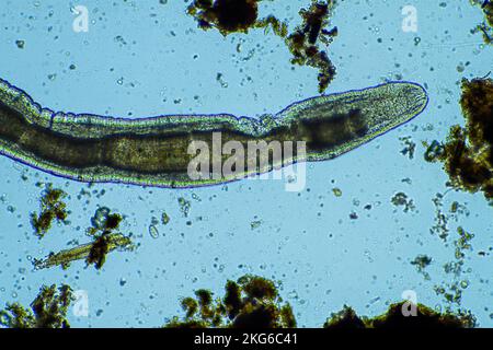 Menschlicher Parasit. Intestinale Infektionskrankheit. Mikroorganismus-Infektion im Krankenhaus beim Menschen Stockfoto