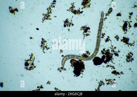 Menschlicher Parasit. Intestinale Infektionskrankheit. Mikroorganismus-Infektion im Krankenhaus beim Menschen Stockfoto