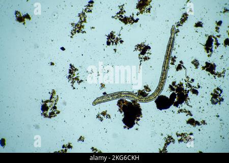 Menschlicher Parasit. Intestinale Infektionskrankheit. Mikroorganismus-Infektion im Krankenhaus beim Menschen Stockfoto