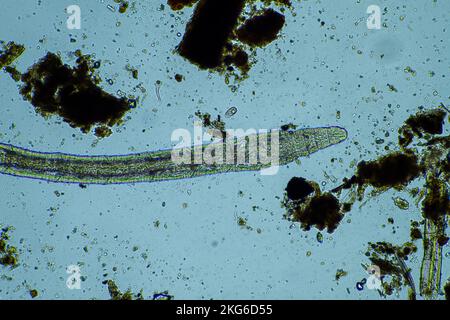 Menschlicher Parasit. Intestinale Infektionskrankheit. Mikroorganismus-Infektion im Krankenhaus beim Menschen Stockfoto