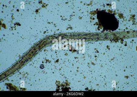 Menschlicher Parasit. Intestinale Infektionskrankheit. Mikroorganismus-Infektion im Krankenhaus beim Menschen Stockfoto