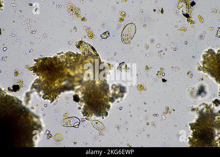 Menschlicher Parasit. Intestinale Infektionskrankheit. Mikroorganismus-Infektion im Krankenhaus beim Menschen Stockfoto