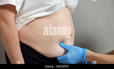 Die Hände des Arztes in Gummihandschuhen untersuchen den Bauch des Patienten Stockfoto