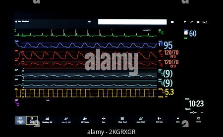 Anzeige eines bettseitigen Patientenmonitors in einem englischen Krankenhaus. Stockfoto