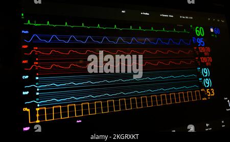 Anzeige eines bettseitigen Patientenmonitors in einem englischen Krankenhaus. Stockfoto