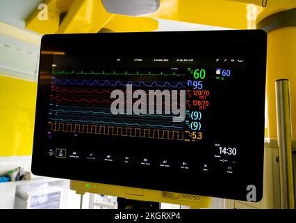 Anzeige eines bettseitigen Patientenmonitors in einem englischen Krankenhaus. Stockfoto