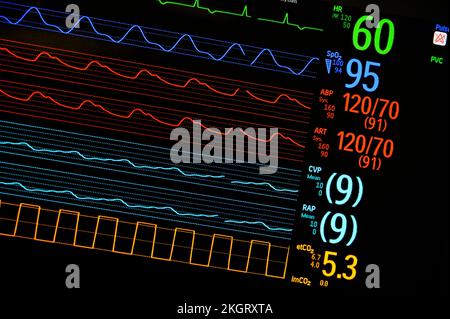 Anzeige eines bettseitigen Patientenmonitors in einem englischen Krankenhaus. Stockfoto