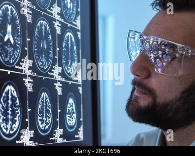 Arzt mit Bart untersucht MRT-Hirnscan Stockfoto