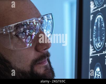 Arzt trägt eine Brille und sieht sich einen MRT-Scan an Stockfoto