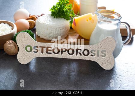 Osteoporose-Konzept. Für Osteoporose empfohlene Lebensmittel, kalziumreiche und nicht kalziumreiche Tagebücher. Stockfoto