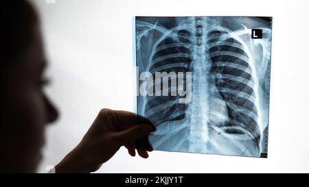 Arzt zeigt Röntgenaufnahme der Lunge des Patienten. Stockfoto