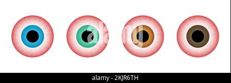 Rote Augen, verschiedene Farben eingestellt. Krankheitsstress, Schlafstörungen, Kapillaren und Pupillen. Stock Vektor