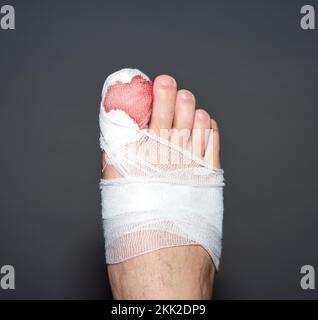 Fuß große Zehe Bandage verletzte Füße in der medizinischen Klinik  Krankenhaus Zentrum Stockfotografie - Alamy