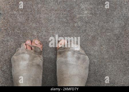Dreckige Männerfüße in undichten, abgenutzten Socken. Armut. Hintergrund Stockfoto
