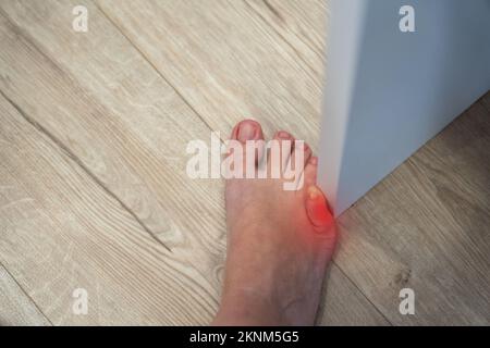 Die Frau hat die Möbel mit dem kleinen Zeh getroffen. Vorfall zu Hause. Roter Fleck mit Verletzung eines kleinen Fußfingers Stockfoto