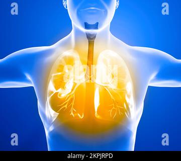 Menschliche Anatomie, Probleme mit dem Atmungssystem, schwer geschädigte Lungen. Bilaterale Pneumonie. Covid-19, Coronavirus. Patient und Rauch. Raucher Stockfoto