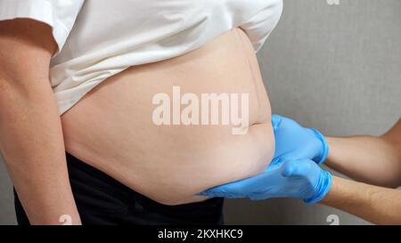 Die Hände des Arztes in Gummihandschuhen untersuchen den Bauch des Patienten Stockfoto