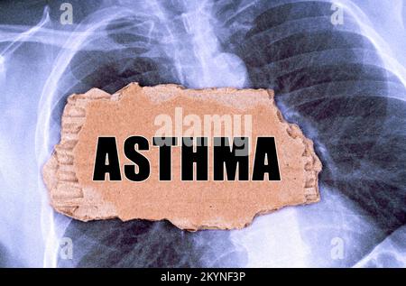 Medizinisches Konzept. Auf dem Röntgenbild ist ein Stück Pappe mit der Aufschrift - Asthma Stockfoto