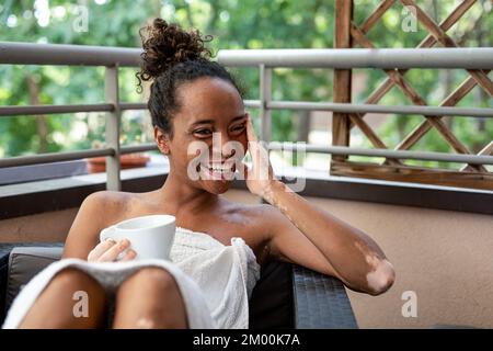 Junge afrikanische brasilianische Frau lächelt und trinkt einen Drink während eines sorgenfreien Moments im Spa, Frau mit Vitiligo, die sich im Urlaub auf dem Balkon entspannt Stockfoto