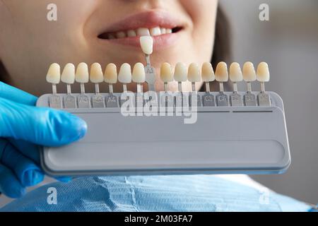 Zahnarzt wählt den Farbton des Zahnschmelzes für den Patienten. Zahnarztprobe aus der Zahnschmelzskala Stockfoto