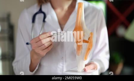 Eine Physiotherapeutin hält ein anatomisches Modell des menschlichen Kniegelenks und eines Kugelschreibers in den Händen. Stockfoto