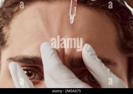Zugeschnittenes Bild von MenschenStirn und Kosmetikhänden, die Anti-Falten-Injektionen machen. Anheben des Gesichts. Das Konzept der männlichen Schönheit, plastische Chirurgie Stockfoto