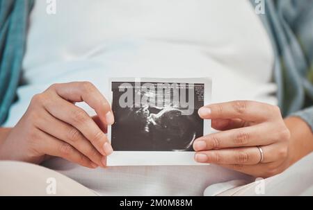 Schwangerschaft, Liebe und Hände mit dem Scan des Babys mit einer Frau, die sich für die Zukunft mit Familie, Kindern und Kindern freut. Gesundheit, Neugeborenes und Hand of Stockfoto