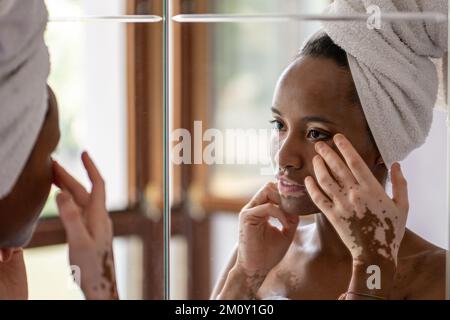 Junge afrikanische brasilianische Frau mit Vitiligo mit Handtuch Blick auf Spiegel ihr Gesicht und ihre Hände, Hautpflege und genetische Pigmentierungskonzepte Stockfoto