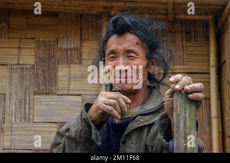 Ziro, Arunachal Pradesh, Indien - 02 24 2009 : Porträt eines lächelnden Apatani-Stammesmanns mit traditionellem frontalem Haarbrötchen und Kinn-Tattoo Stockfoto