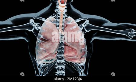 3d-Darstellung des Pneumothorax, normale Lunge versus kollabiert, Symptome des Pneumothorax, Pleuraerguss, Empyema, Komplikationen nach einer Brustverletzung Stockfoto